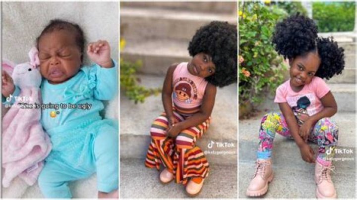 “Absolutely Gorgeous”: Transformation Photos of Kid Described "Ugly" As Baby Surprises People