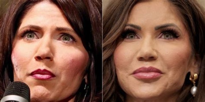 Billie Lee Before And After: Did She Have Surgery?
