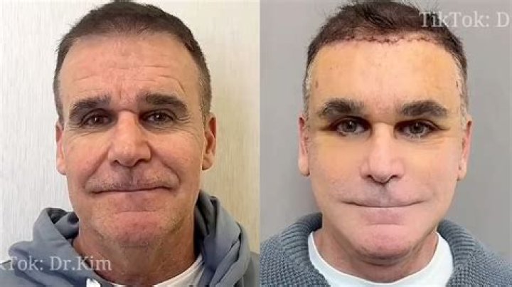 Bruna Biancardi Plastic Surgery Viral On Tiktok: Before And After Photo