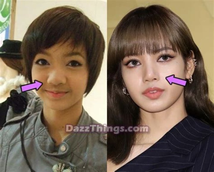 Did Jennie from Blackpink Get Plastic Surgery? A Look into Some Speculations