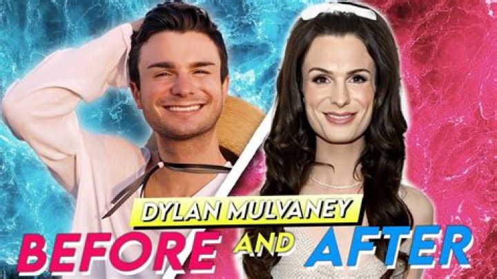 Dylan Mulvaney Weight Loss: Plastic Surgery And Transformation
