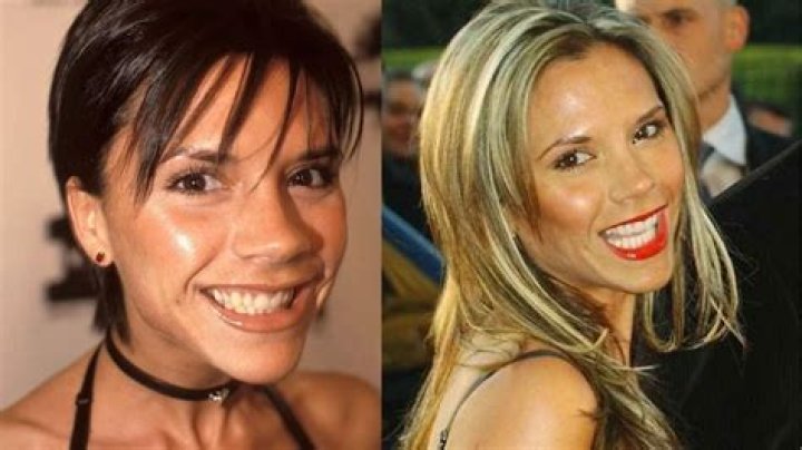 Has Victoria Beckham Done Weight Loss? Before And After