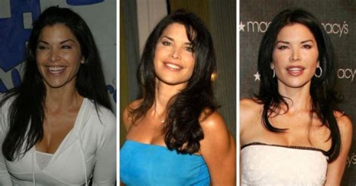 Hosea Sanders Plastic Surgery: Before And After Photos
