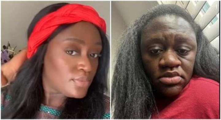"My Nose Swelled Up": Lady Posts Unbelievable Changes Her Body Went Through During Pregnancy, Video Goes Viral