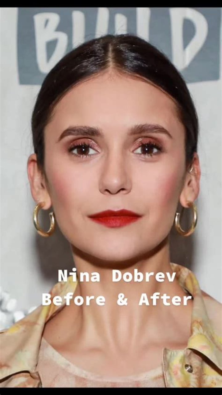 Nina Dobrev Weight Loss Before And After: Illness And Health 2023