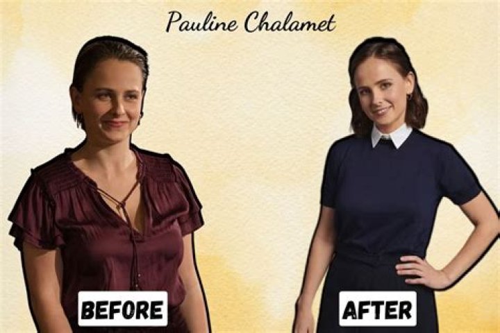 Pauline Chalamet Breast Reduction: Timothee Sister Weight