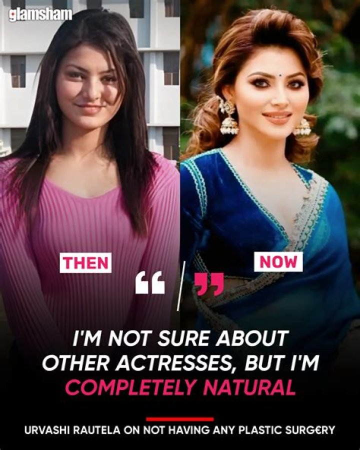 Urvashi Rautela Plastic Surgery: Before And After Photo