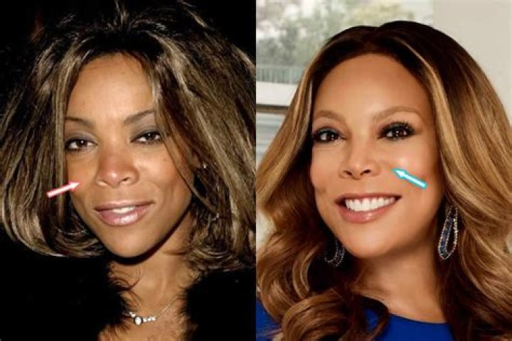 Wendy Williams Plastic Surgery Before And After: Botox And Nose Job