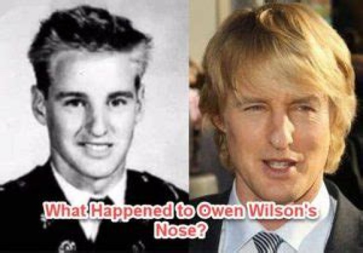 What Happened to Owen Wilson's Nose? The Reason Why It's Crooked